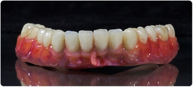 Denture, dental bridge, Image Cerdit: Goran Cakmazovic / Shutterstock